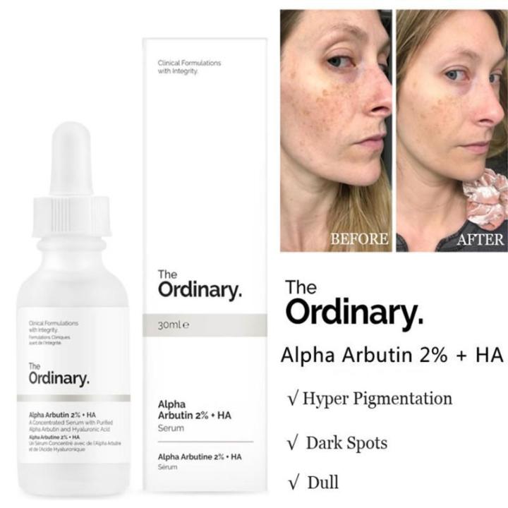 ของแท-the-ordinary-alpha-arbutin-2-ha-concentrated-serum-ลดเลือนจุดด่างดำ-ยกกระชับผิว-ฟื้นฟูผิว-30ml