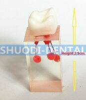 4Pcs 1:1เรซิ่นทันตกรรม Endodontic นักเรียน Study Practice การดำเนินงานรุ่นสี Root C Pulp สำหรับ RCT Practice