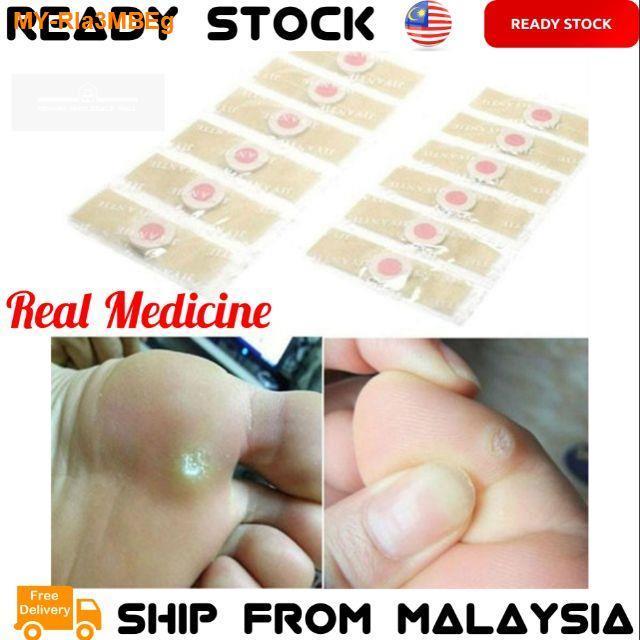 New JIYANTIE Paste Foot Corn Plasters [ Remove The Corns ] Paste Clavus ...