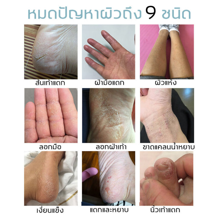 pyk-ครีมทาส้นทาแตก-ครีมทาเท้าแตก-สะลอวัย-moisturizing-ไวท์เทนนิ่ง-การดูแลหนังกำพร้า-ครีมทาส้นเท้า-ครีมทาเท้า-ครีมทาส้นเท้าแตก-ส้นเท้าแตก-ครีมทาเท้าขาว-foot-cream-ครีมส้นเท้าแตก-ครีมบำรุงเท้า-ครีมทาส้น