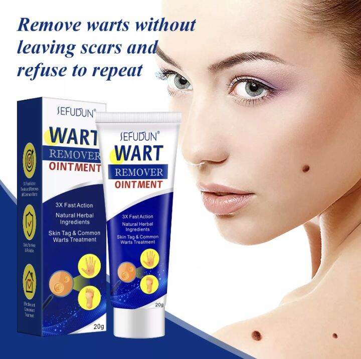 Warts Remover Cream Warts Magic Remover Wart Ointment Wart Removal 