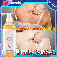 กรดอะมิโน ครีมอาบน้ำ 260ML เจลอาบน้ำ กำจัดไรและสิวให้ความชุ่มชื้น เพื่อกำจัดไขมันและสิ่งสกปรก ทำให้ผิวเรียบเนี ทำให้ผิวเรียบเนียนและชุ่มชื้น ควบความมัน บอดี้ วอช ครีมอาบน้ำผช สบู่อาบน้ำ สบู่ก้อนอาบน้ำ