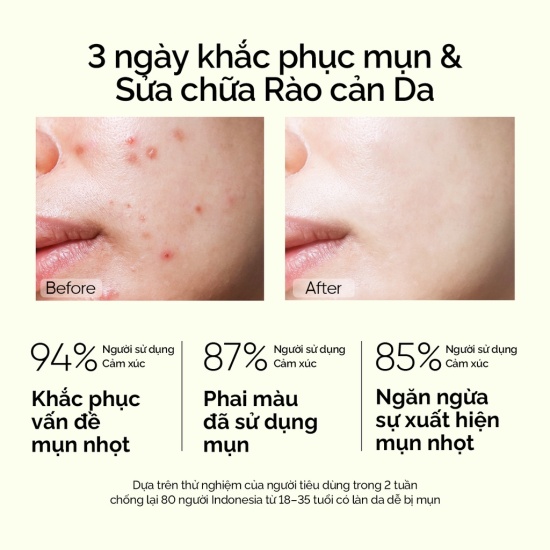 Serum mụn skintific chính hãng rulya anti acne 20ml - ảnh sản phẩm 4
