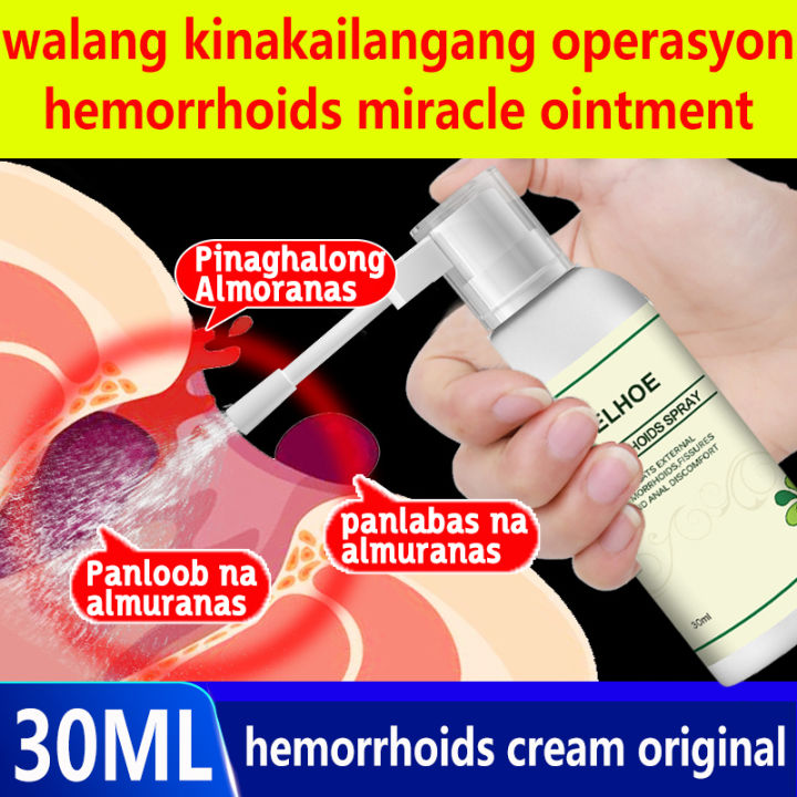 No Surgery Required Hemorrhoids Spray Treatment Of Hemorrhoids Relieve 7477