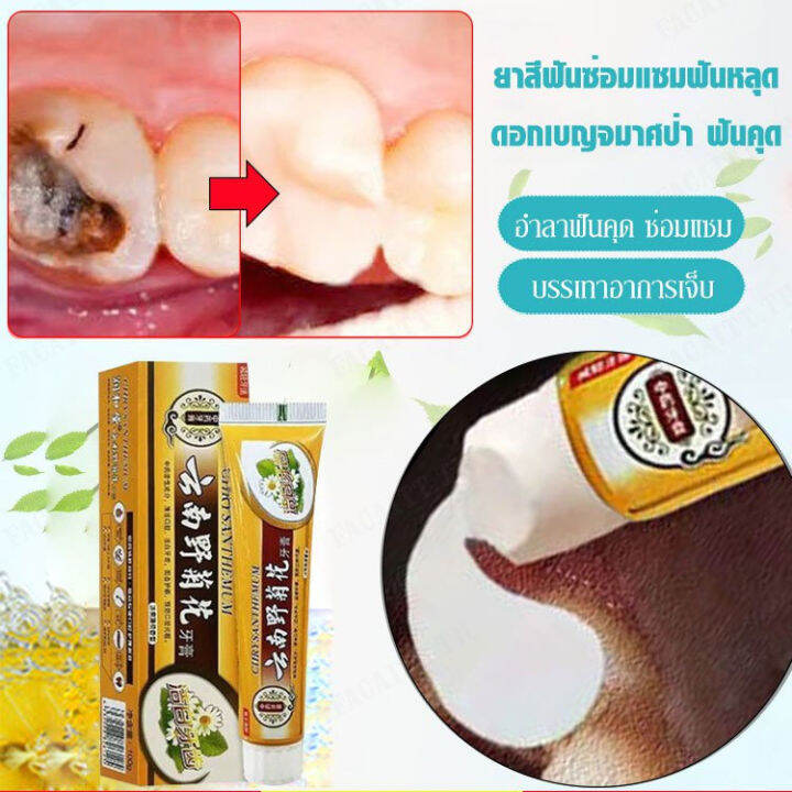 jjmakro Toothpaste, repairing cavities, filling and repairing cavities ...