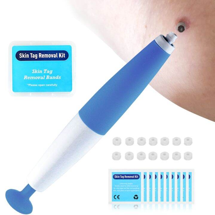 Skin Tag Kill Skin Mole Wart Remover Micro Skin Tag Removal Kit With Cleansing Swabs Adult Mole