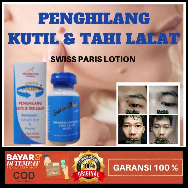 SALEP SWISS PARIS LOTION PENGHILANG KUTIL MATA IKAN KELOID KAPALAN
