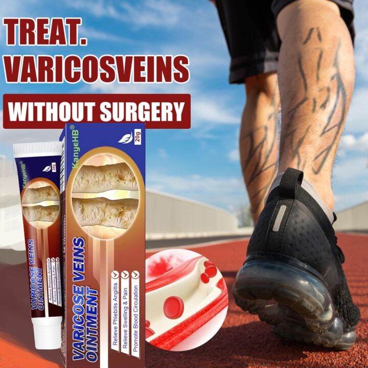 Varicose Gel Veins Remover and Sun Cream Varicose treatment first aid Supplies Pain Relief