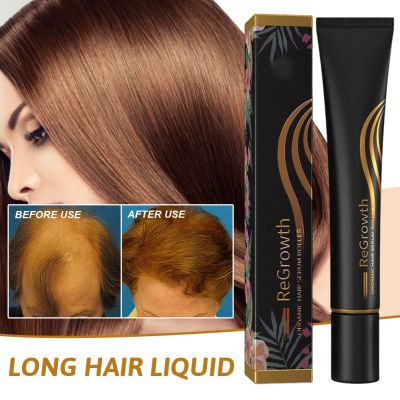 MUS Triple Roll-On Massager Hair Growth Essences For Men &amp; Women Of All Hair Types