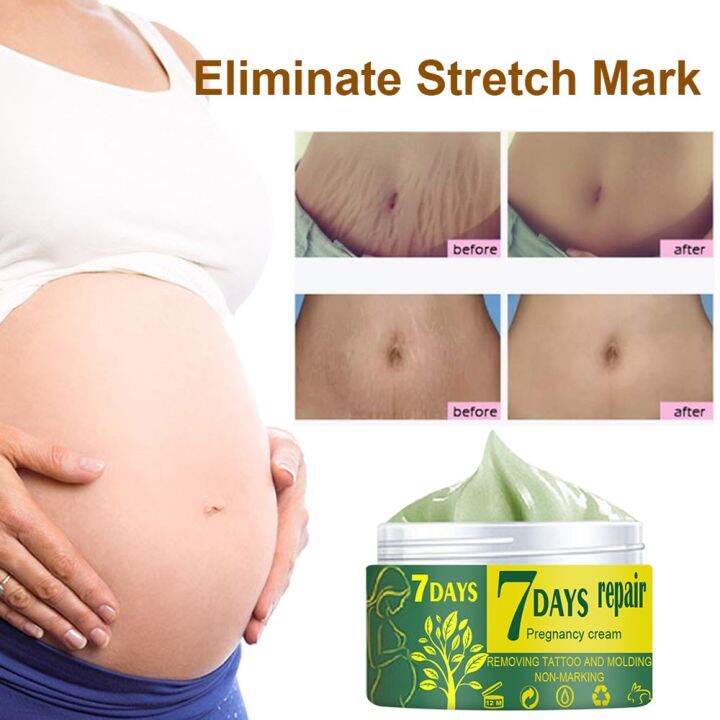 บอดี้ครีมรักษาไขมัน-krim-stretch-mark-ครีมลบรอยแตกลายกำจัดรอยแผลเป็นจากสิวซ่อมแซมการตั้งครรภ์-striae-gravidarum