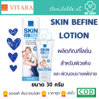 Vitara Skin Befine Lotion Soothing Lotion 30g. ไวทาร่า สกินบีไฟน์ โลชั่น โลชั่นสำหรับผิวแห้ง