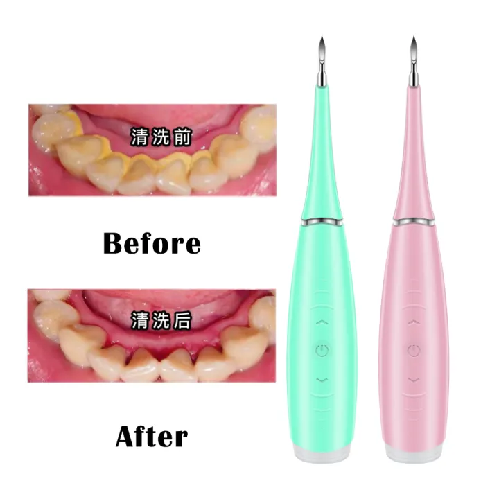 Electric Ultrasonic Scaler Tooth Calculus Remover Cleaner Tooth Stains