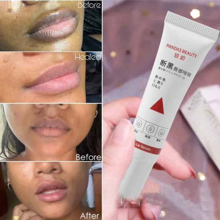 Best Lip Lightening Balm Lips Bleaching Cream Remove Naturally Dark