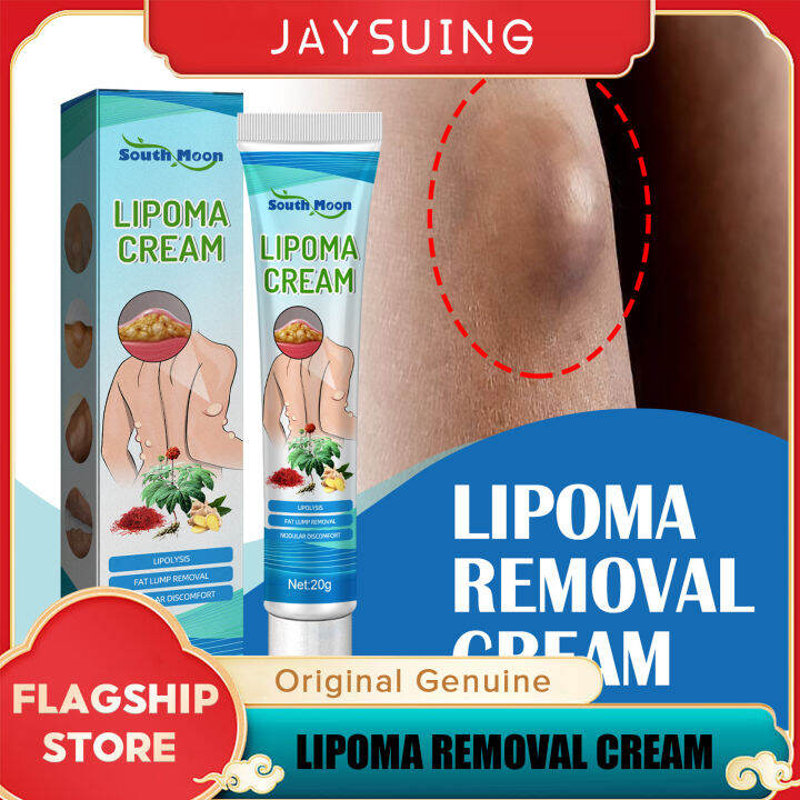 Jaysuing Lipoma Removal Cream Lipolysis Fat Lump Relieve Lipoma Removal