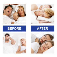 30pcs Anti Snore Mouth Stickers Improve Sleep Quality Anti Snoring Solution for Reducing Mouth Breathing S6-TOP1A-TH