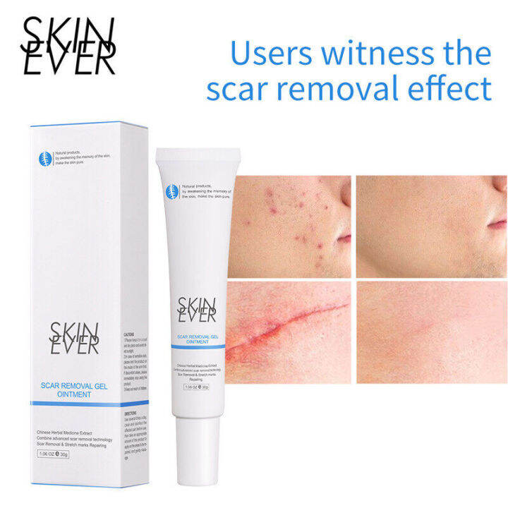 silky-intact-skin-ever-cream-remove-scar-cream-moisten-scar-formula-safe-denigrate-denigrate-skin-scar-repair-scar-from-mosquito-bite-รอยแผล-is-herbal-slimming-cream-repair