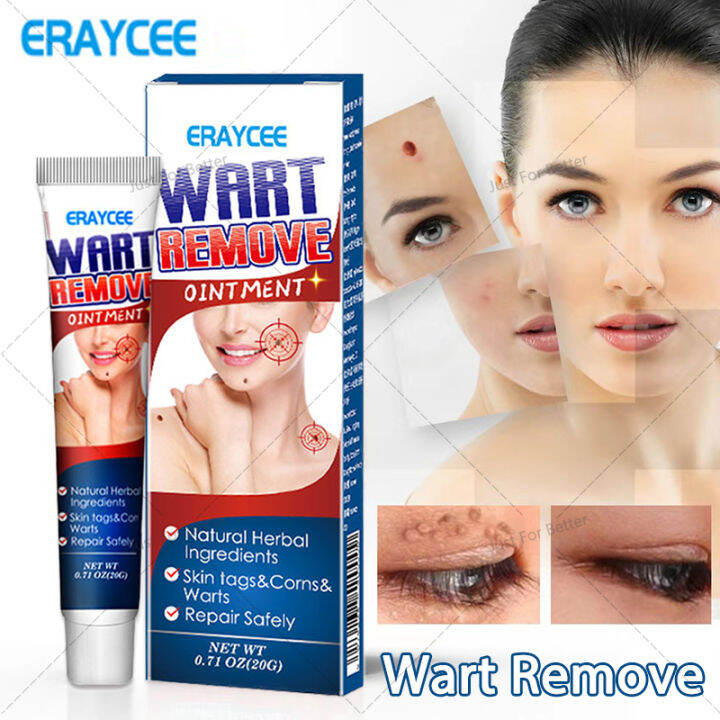 ERAYCEE Warts Remover Ointment Skin Mole Remover Wart and Skin Tag ...