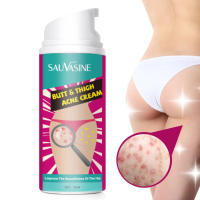 Hips and Legs Acne Cream Remove Acne &amp; Pimples Moisturizing Cream Removing Blackheads Dark Spots