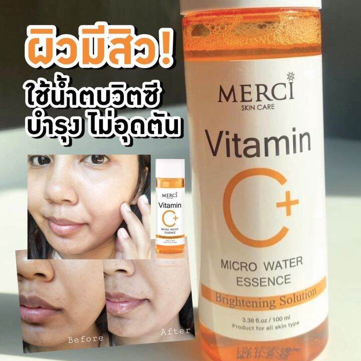 ใหม่-แท้-จากบริษัทโดยตรง-น้ำตบวิตซี-เมอร์ซี่-merci-vitamin-c-essence-100ml-น้ำตบสยบสิว