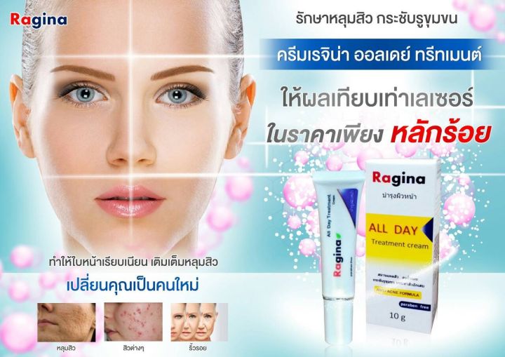 รักษาหลุมสิว-ครีมเรจิน่า-all-day-treatment