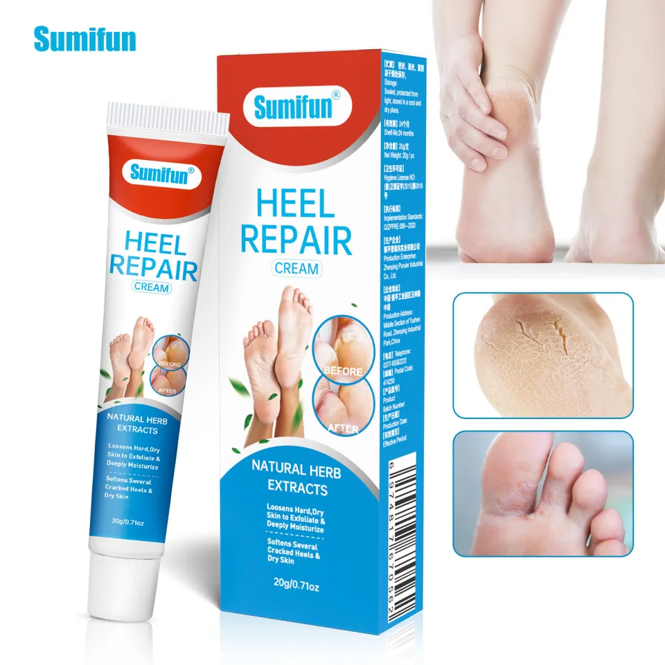 COD]Sumifun foot cream cracked heel remover hand cream for dry hands Foot  cream for Cracked heels callus removal for foot pair with callus remover  foot grinder callus cream remover Moisturizing Cracked Callus