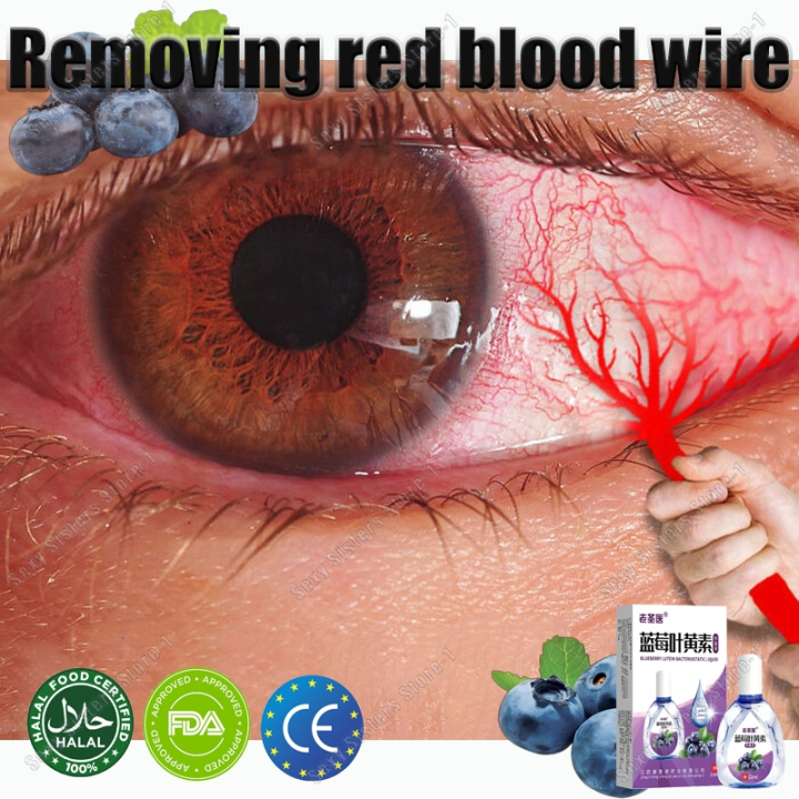 [100 Blueberry]Eye Drops for dry Eye drops eye Cataract滴眼液12ml Care