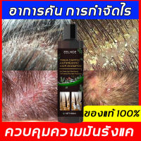 【ส่งจากกรุงเทพ】EELHOE 100ml ขจัดรังแค หยุดอาการคัน ควบคุมน้ำมัน (แชมพูขจัดรังแค ขจัดรังแค ยาสระผมเชื้อรา แชมพูสมุนไพรยาสระผม ยาสระผมรังแค แชมพูแก้เชื้อรา แชมพูรักษารังแค ยาสระผมขจัดรังแค ดูแลหนังศีรษะ ยาสระผมแก้เชื้อรา ยาสระผม แชมพูคัน บำรุงรากผม)