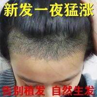 [3 days without hair growth and full retreat] Genuine anti-shedding and anti-hair loss tonic for hair baldness