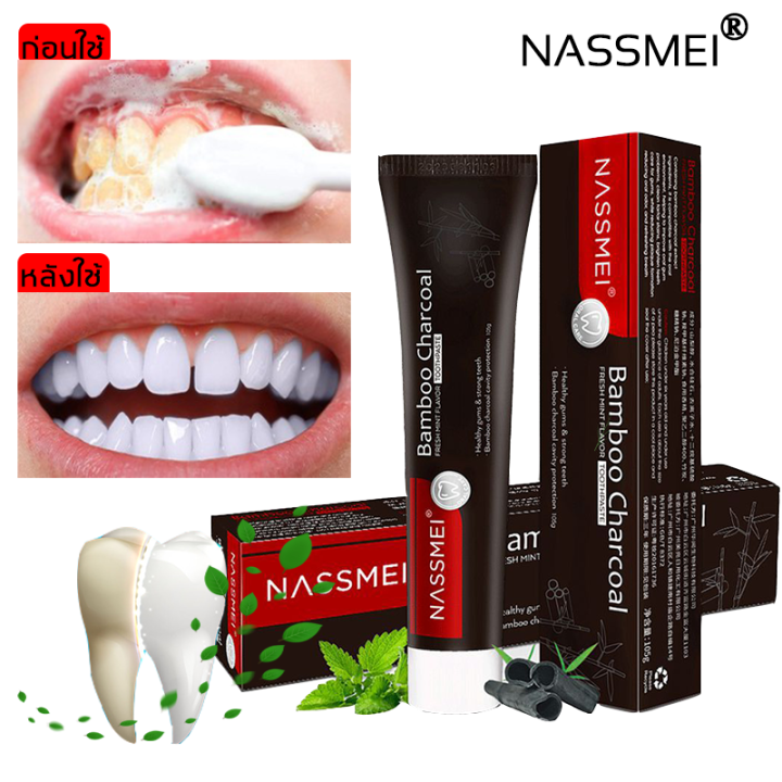 ยาสีฟัน NASSMEI ไม่จำเป็นต้องทำความสะอาดฟันคุณสามารถบอกลาแคลคูลัสและ ...