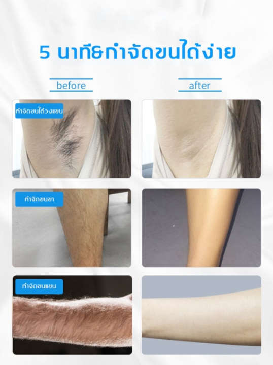ส่งไวไม่ต้องรอ100-ครีมกำจัดขน-150ml-จะไม่มีขนแล้ว-ครีมจำกัดขน-กำจัดขนอย่างอ่อนโยน-ไม่ทำร้ายผิว-ไม่มีร่องรอย-มูสกำจัดขน-กำจัดขนขา-สเปร์กำจัดขน-กำจัดขนรักแร้-ที่กำจัดขน-โฟมกำจัดขน-ครีมกำจัดขนร่างกาย-แว๊