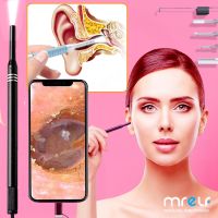 Usb Endoscope Android Ear Cleaning the Ears Endoscopic Camera for Mobile Clean Your Digital Otoscope Inspection Smartphone Phone