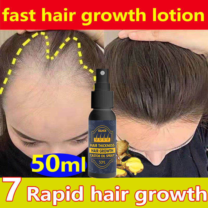 Effective 100 Natural Grower Fast Long Hair Treatment Minoxidil Hair