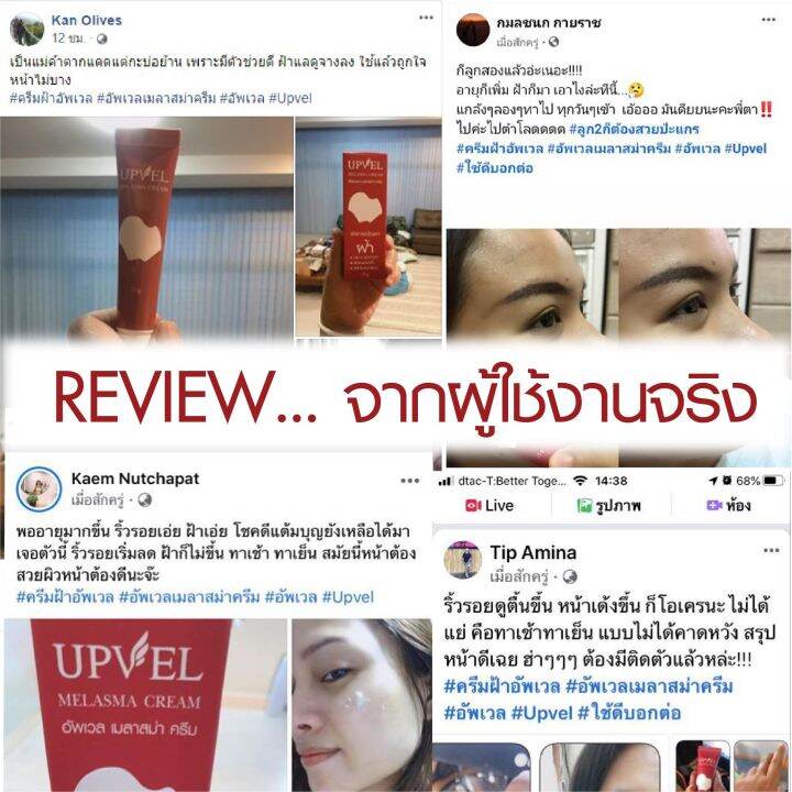 upvel-melasma-cream-อัพเวล-เมลาสม่า-ครีม-15-กรัม