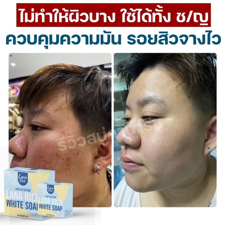 พร้อมส่ง-ครีมอาบูติน-สบู่ลาน่า-ริช-lana-rich-white-soap-ลา-น่า-ริช-เร่งขาว-ขาวเเรงง-สบู่ผิวตัว-ผสมอาร์บูติน-และ-กลูต้า-ลดรอยแตกลาย