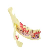 Dental Endodontic Treatment Model Anatomical Model Teaching Studying Model Dental Materials