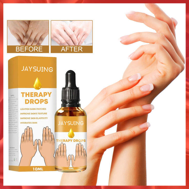 Jaysuing Therapy Drops Therapy Oil Acanthosis Nigricans Spot Treatment ...