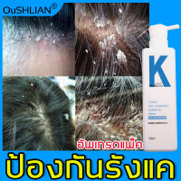 ลดอาการคัน ควบคุมความมัน แชมพูต้านเชื้อรา ซ่อมแซมผมเสีย แชมพูแก้ผมร่วง OUSHLIAN ครีมนวดผม แชมพูมะกรูด บำรุงหนังศีรษะ แชมพูขจัดรังแค