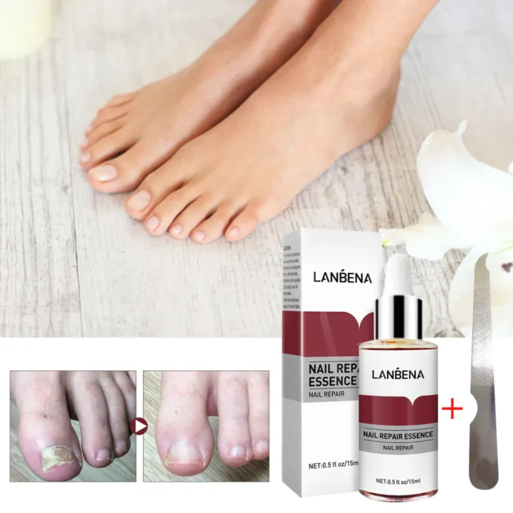 LANBENA Nail Repair Essence Fungal Nail Treatment Serum Removal ...