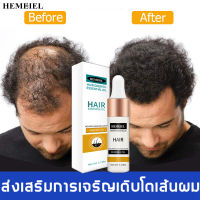 HEMEIEL  ฟื้นฟูผมแห้งเสียยาปลูกผมผู้ชาย เร่งผมยาวไว ป้องกันผมร่วง ลดผมร่วง น้ำยาปลูกผม ยาปลูกผ ผู้ชาย ยาปลูกผม น้ำยาเร่งผมยาว เซรั่มปลูกผม ปลูกผมเร่งด่วน ปลูกผม