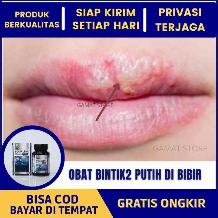 Obat Penghilang Bintik Putih Di Bibir, Bintik2 Merah Pada Kulit Badan