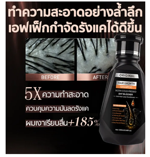 ลดกระหน่ำ-peimei-แชมพูแก้ผมร่วง-ยาสระผมเร่งยาว-ยาสระผมแก้ร่วง-250ml-สูตรน้ำขิง-ปลูกผมอย่างอ่อนโยน-บำรุงรากผม-แชมพูปลูกผมดก-แชมพูสระผม-แชมพูเร่งผมยาว-แชมพูลดผมดก-แชมพูขิง-แชมพูสมุนไพร-แชมพูป้องกัน-ร่วง