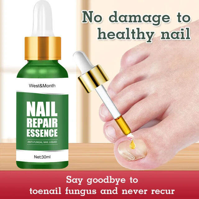 Lanrui Restore Damaged Nails with our Nail Care Solution Lazada PH