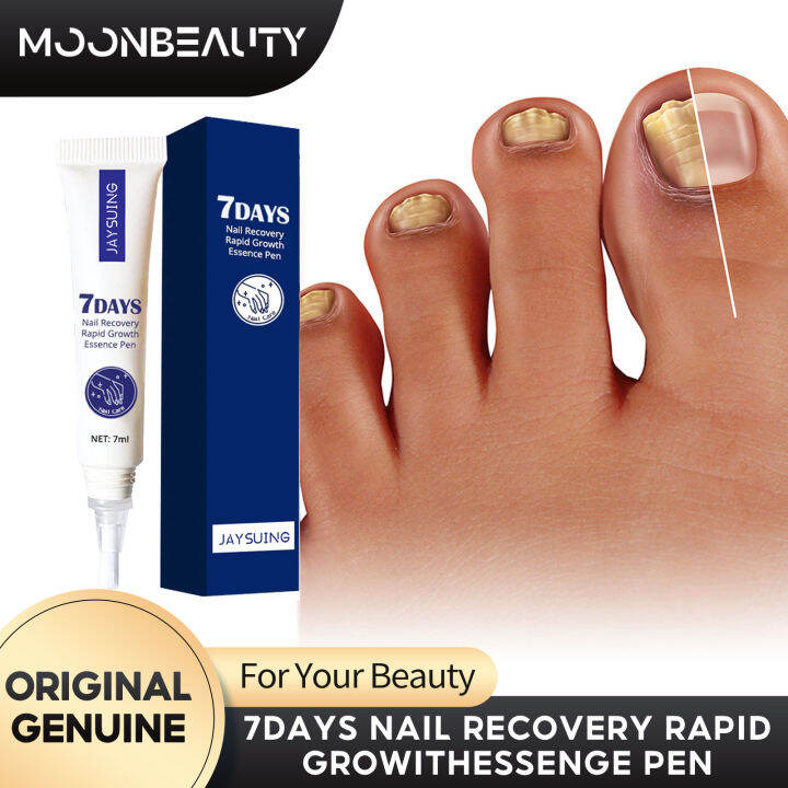 Jaysuing Repairing Nail Essence Softening Toenails Infections Removal ...