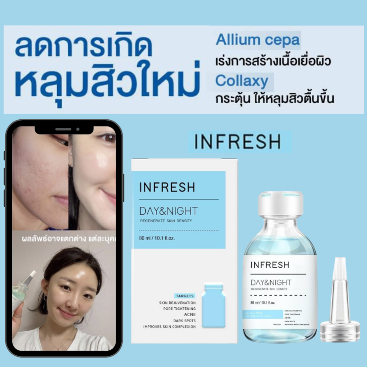 อินเฟรช-เซรั่ม-30มล-infresh-serum-รักษาหลุมสิว-ผิวกระชับ-รูขุมขนตื้น-ใช้ได้ทั้งหญิงและชาย-ของแท้-exp-2025