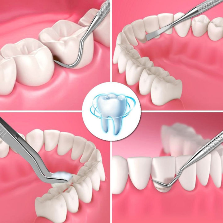 vb-ลด-50-ชุดขูดหินปูน-6ชิ้น-ขูดหินปูน-ทำความสะอาดช่องปาก-มาตรฐานทางทันตกรรม-6-pcs-set-stainless-steel-dentist-tool-teeth-clean-device-tweezer-mirror-dental-probe-dental-hygiene-oral-care