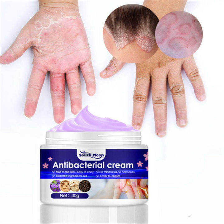 Original Atoderma Cream Gamot sa kati kati sa balat ointment eczema