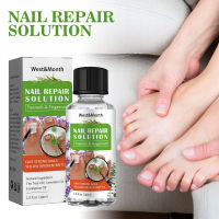 West &amp; Month tea tree oil toenail repair essence thickened onychomycosis ingrown nail soft nail repair essence