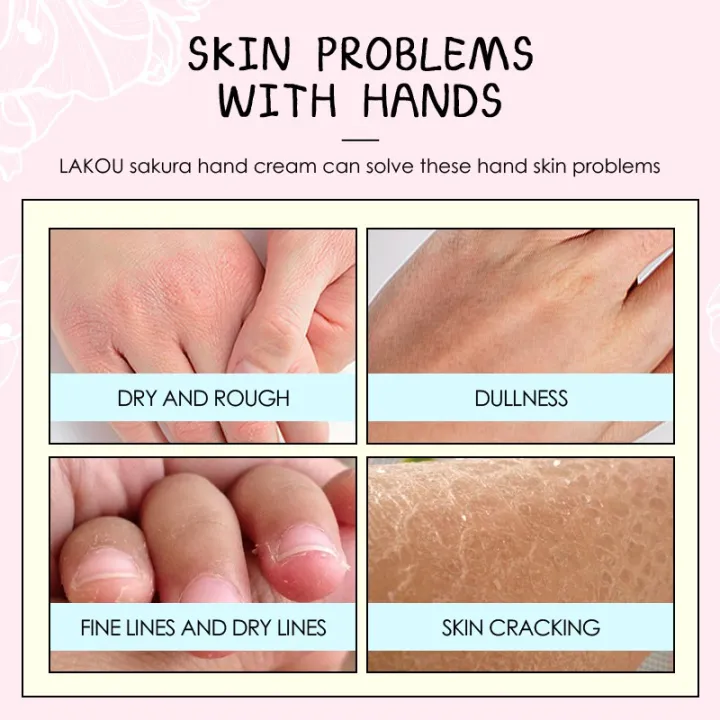 Sakura hand cream moisturizer hand cream for rough hand Nourishing Anti