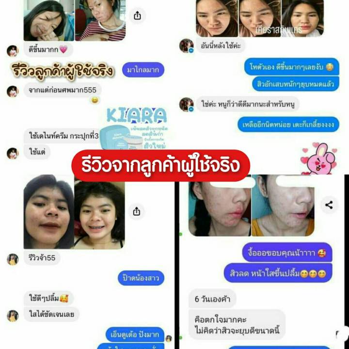 พร้อมส่ง-แพ็คาเกจใหม่-เคียร่า-ครีมหน้าใส-kiara-ลดสิว-ลดฝ้ากระ-จุดด่างดำจางไว3เท่า-หน้ากระจ่างใส