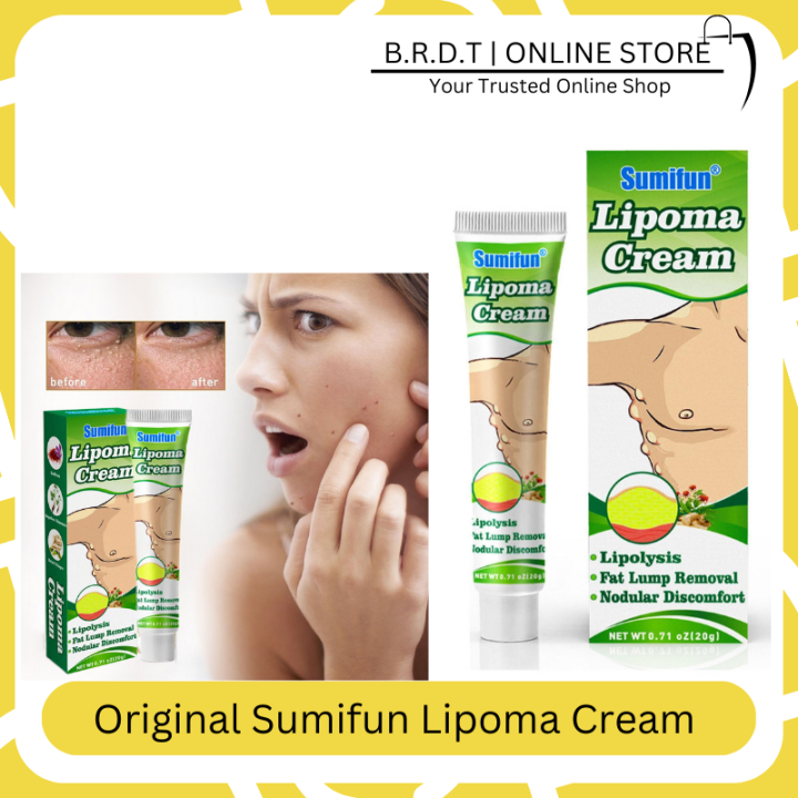 Sumifun Lipoma Removal Cream Lipolysis, Fat Lump Removal Cream （20g ...